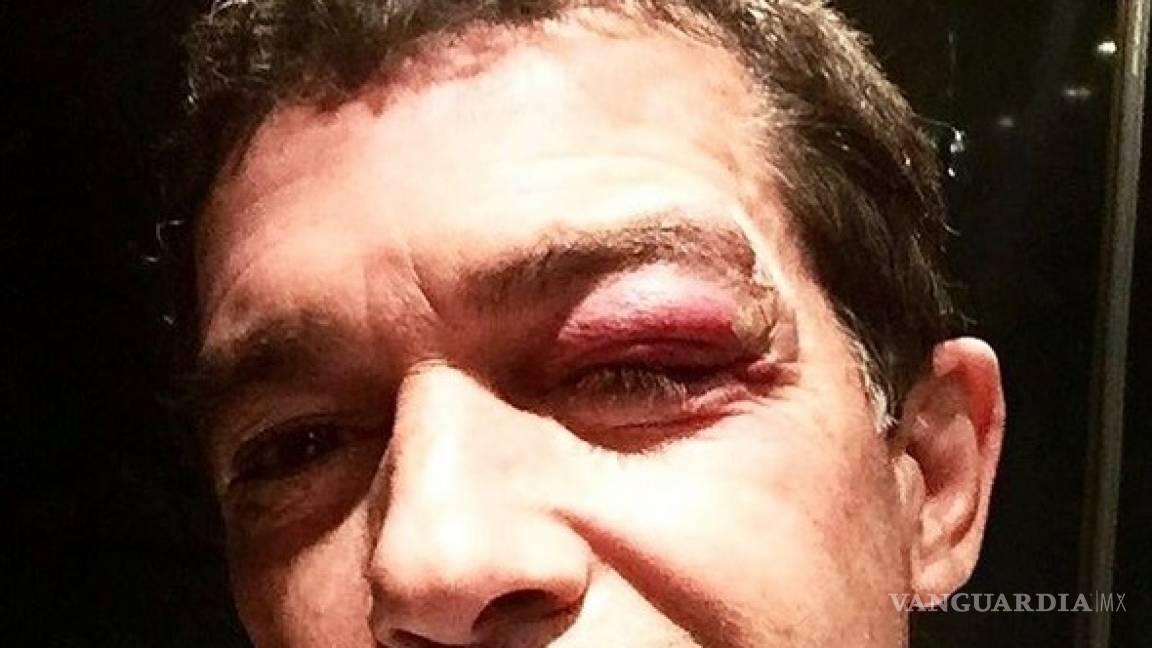 Antonio Banderas sufre grave golpe durante filmación