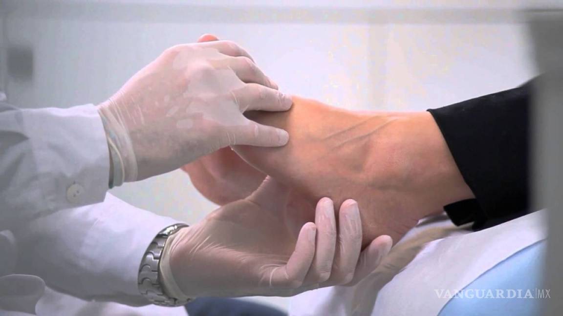 Evitan las amputaciones de pie diabético con nanopartículas