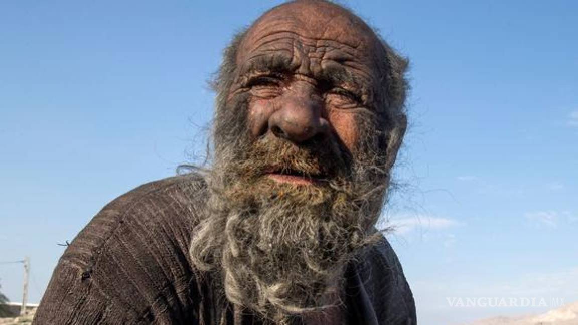 Muere ‘el hombre más sucio del mundo’; no se baño en medio siglo... y vivió hasta los 94 años (video)