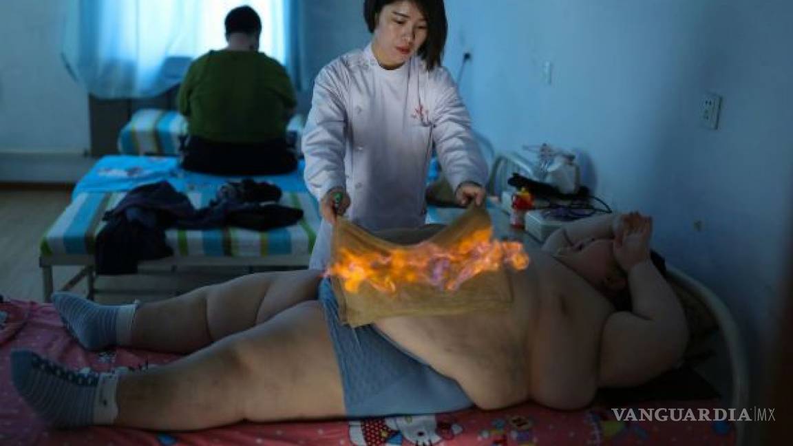 Prenderte fuego, la técnica tradicional china para bajar de peso