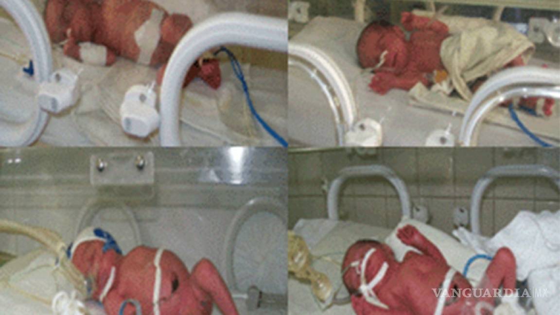 Nacen cuatrillizos en un hospital del ISSSTE de Morelos