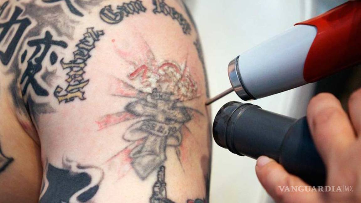 Clínica de Denver ayuda a exconvictos a reiniciar su vida removiendo tatuajes