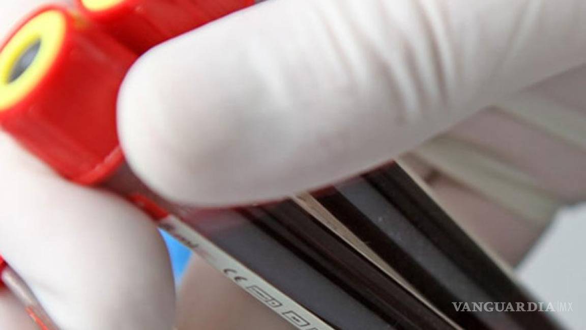 Científicos hallan células donde se aloja VIH