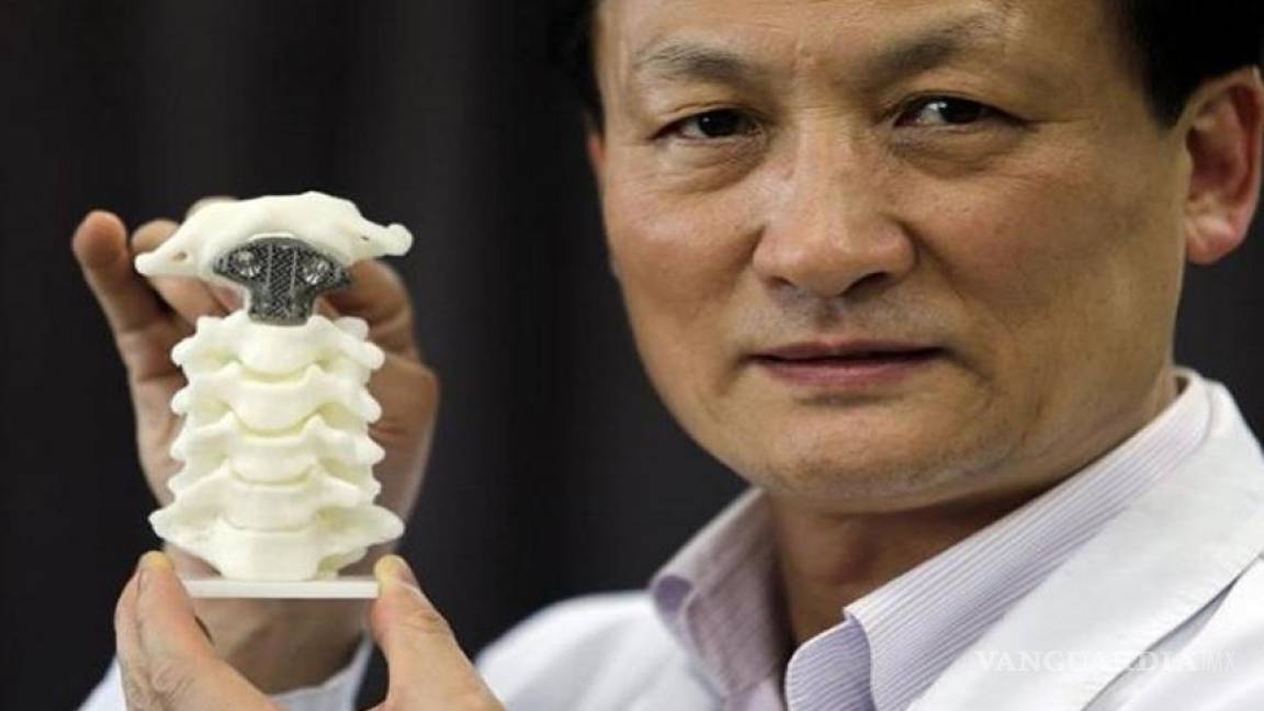 Implantes 3D se extienden en China