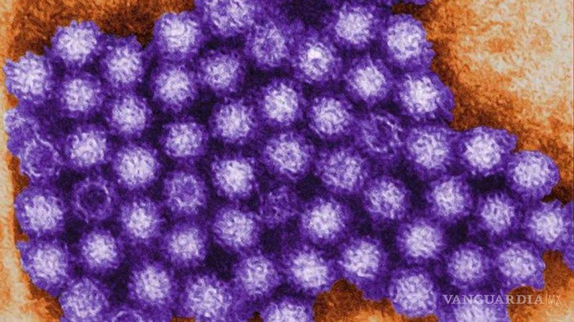 Los norovirus son la causa del 18% de los casos de gastroenteritis