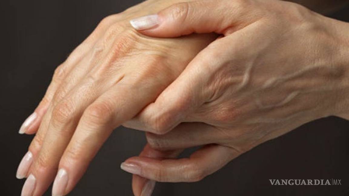 Artritis reumatoide afecta más a mujeres que a hombres; experta