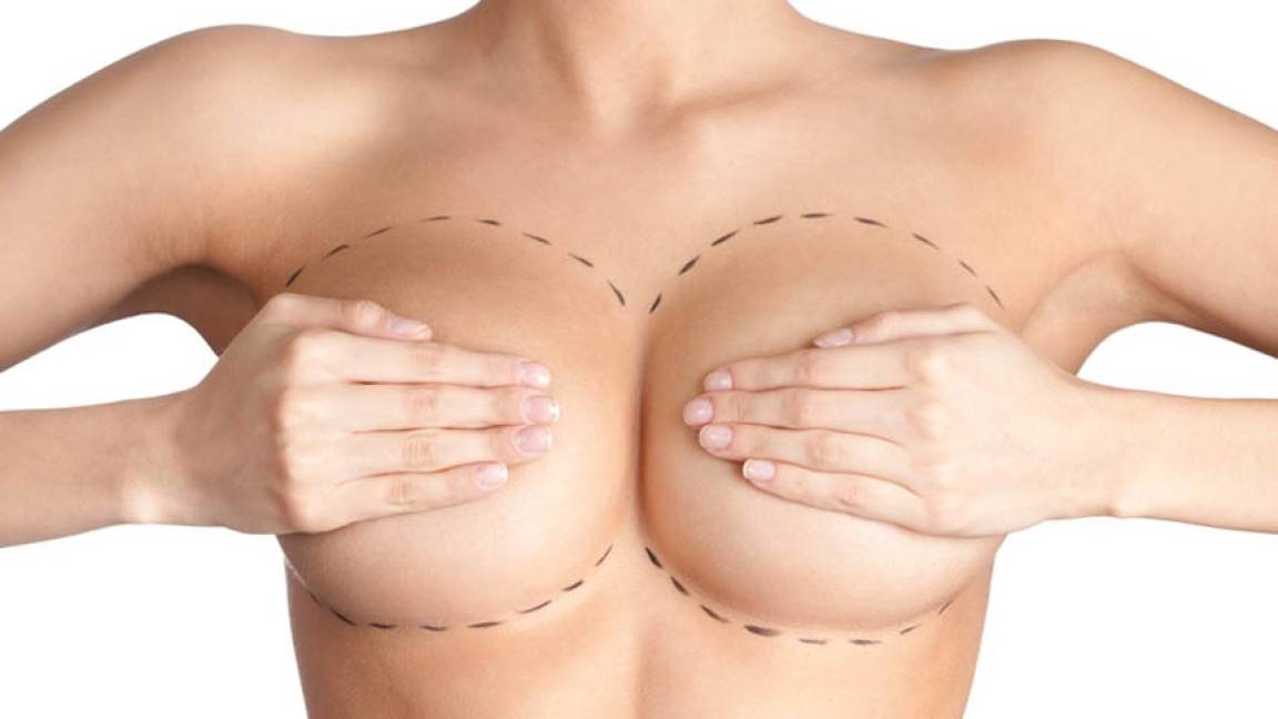 Implantes de seno no provocan cáncer de mama