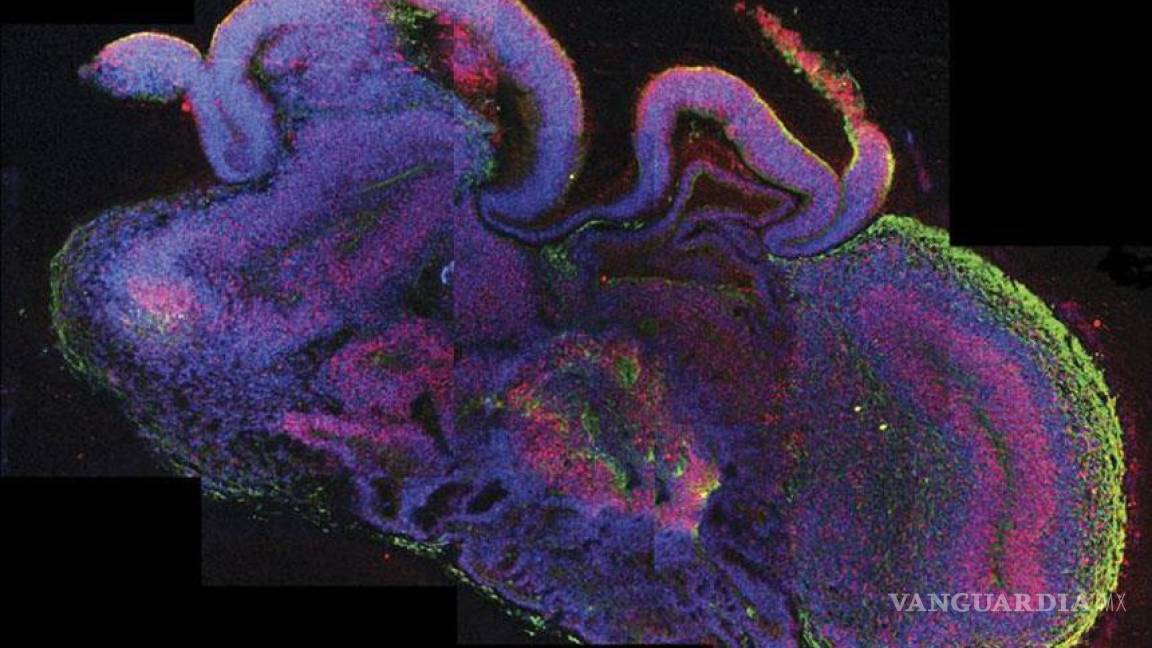 Desarrollan cerebros humanos de 4 milímetros a partir de células madre