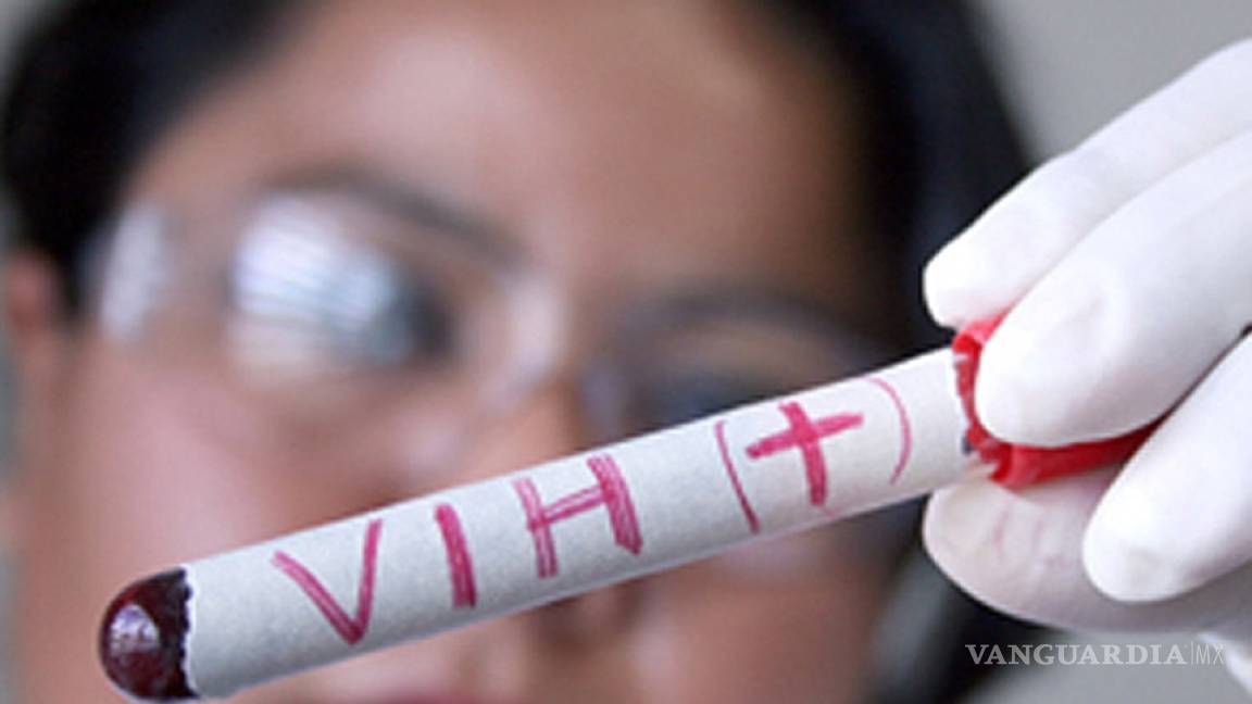 Aumentan casos de mujeres con VIH-Sida en México