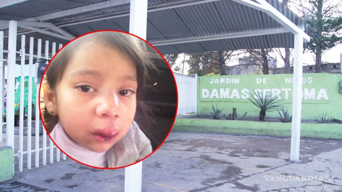 Niña sufre accidente en jardín de niños de Monclova