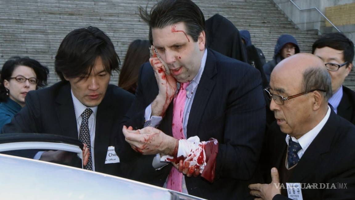 Atacan y lesionan a embajador de EU en Surcorea: medios