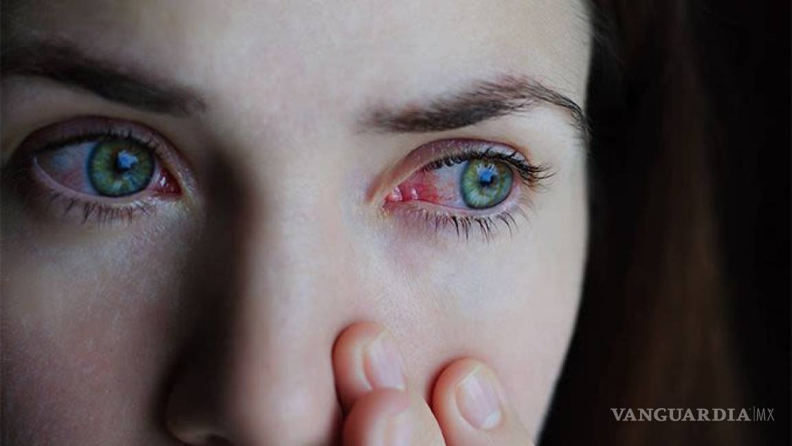 Comezón y dolor de ojos podría ser síntoma temprano de COVID-19