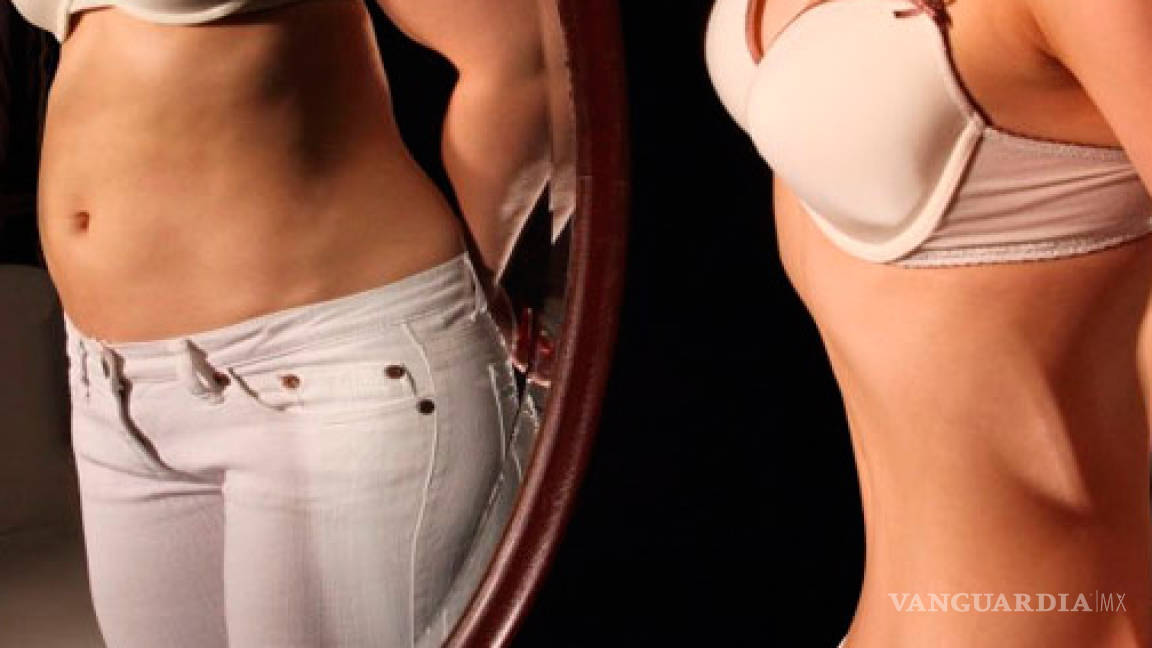 Mujer con anorexia gana amparo y no podrá ser alimentada a la fuerza