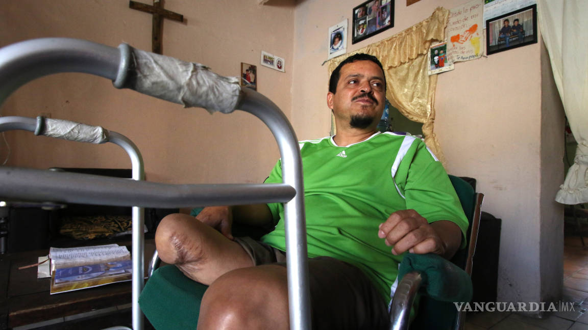 ‘Una burla lo que quieren darme de indemnización': Trabajador municipal que pierde una pierna