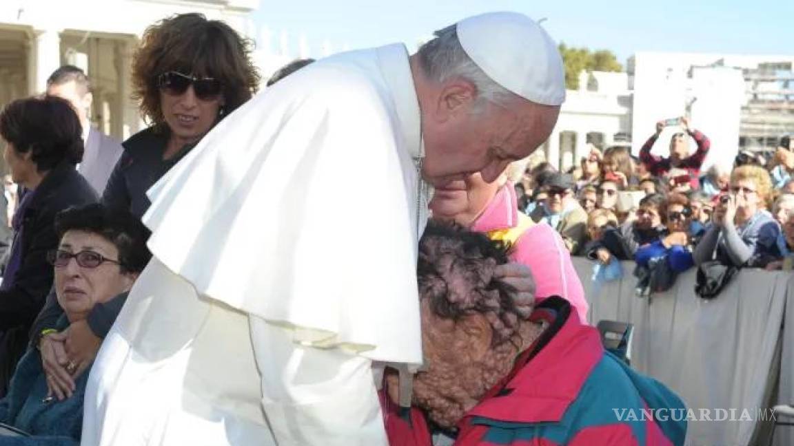 Fallece Vinicio, el hombre enfermo de neurofibromatosis que fue consolado por el Papa Francisco