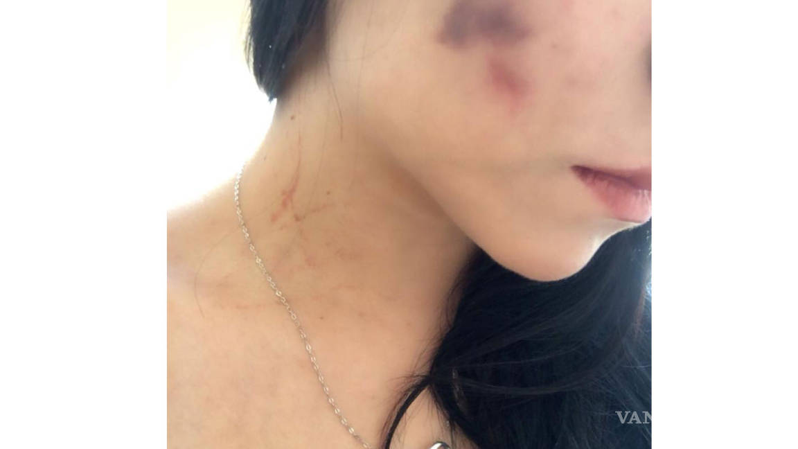 ‘En octubre iniciaron las agresiones’: Porrista de los Saraperos de Saltillo, golpeada por su novio