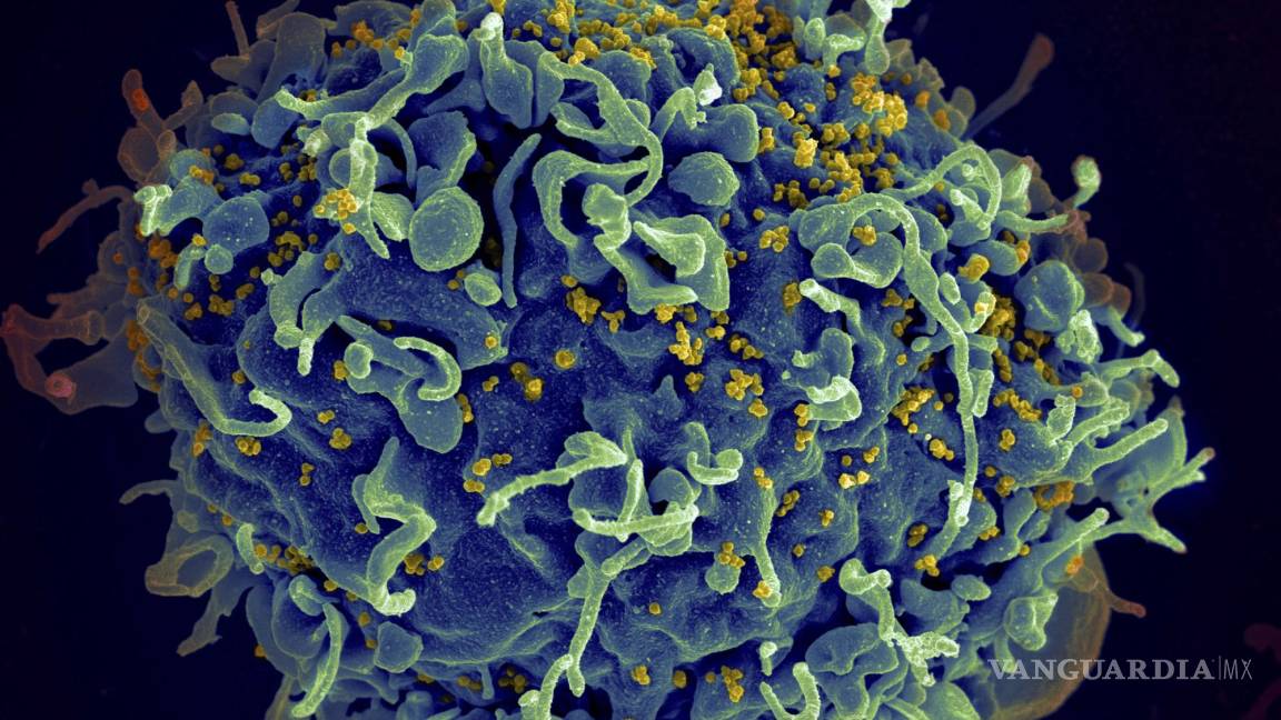 CDC identifica los tres primeros casos documentados de VIH por “faciales vampíricos”