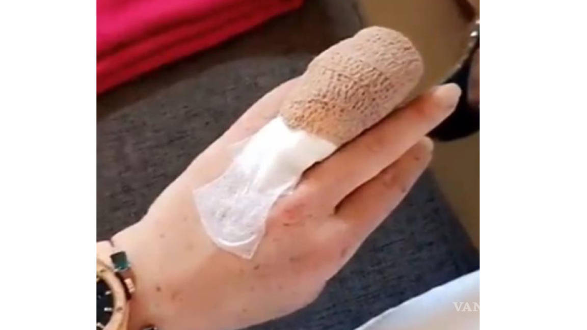 Lindsay Lohan casi pierde un dedo en un accidente