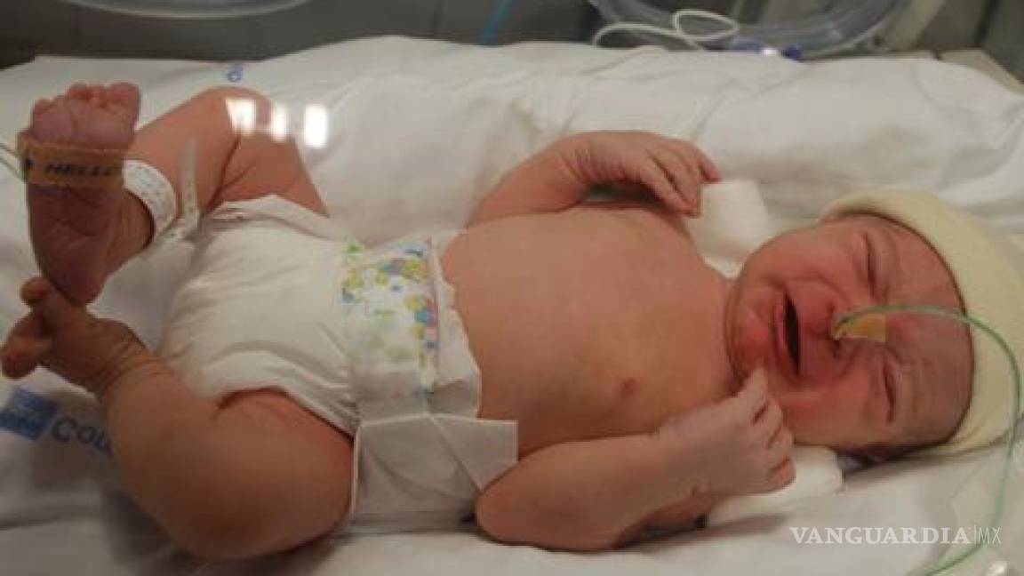 Pulmones de bebés prematuros pueden mejorar con nutrición adecuada