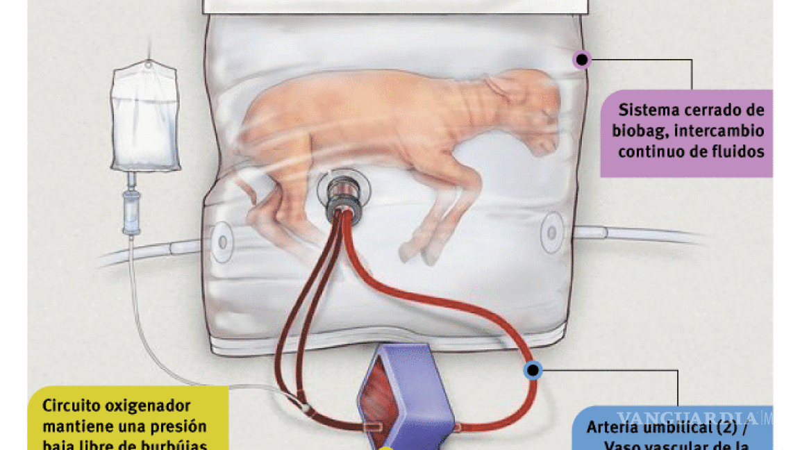 Desarrollan útero artificial para auxiliar a prematuros
