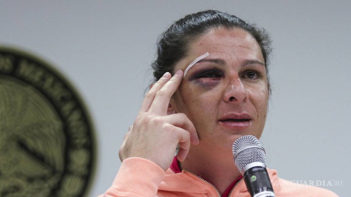 Conceden amparo a agresor de Ana Guevara, delito no es considerado grave