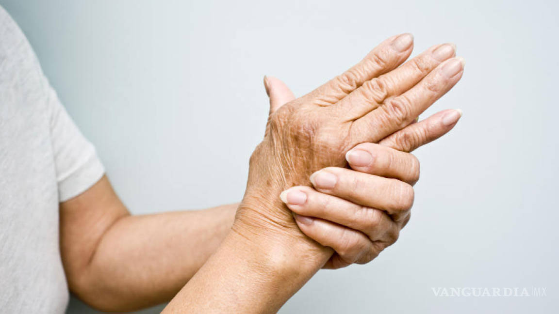 Descubren una nueva forma de tratar la artritis