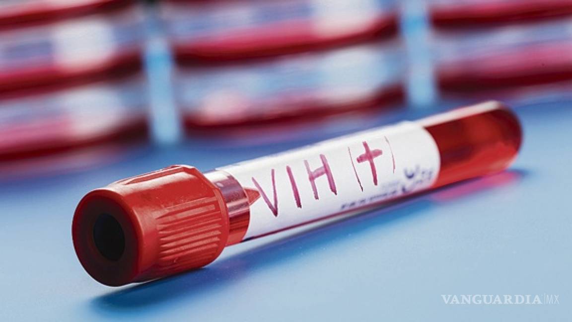 VIH 'desaparece' de la sangre de paciente; científicos podrían tener la cura del virus