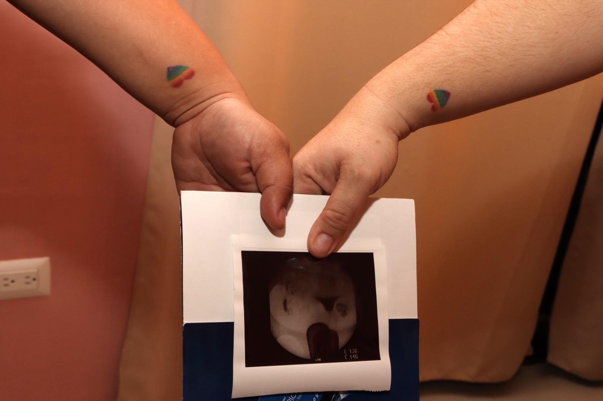$!La muestra para iniciar con el procedimiento de inseminación ya fue colocada en el útero de Naty y ahora la pareja permanecerá en espera de resultados positivos para dentro de 15 días.