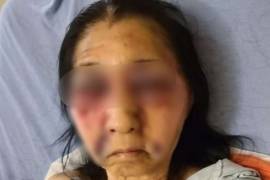 Anciana mexicoestadounidense fue golpeada por otra mujer en Los Ángeles, creyó que era asiática