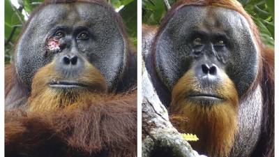 Esta combinación de fotografías muestra una herida facial en Rakus, un orangután macho salvaje de Sumatra en el Parque Nacional Gunung Leuser, Indonesia.