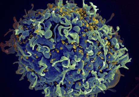 Esta imagen de microscopio electrónico proporcionada por los Institutos Nacionales de Salud de Estados Unidos muestra una célula T humana, en azul, atacada por el VIH, en amarillo, el virus que causa el SIDA.