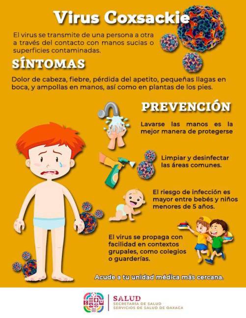 $!Surge brote de virus Coxsackie en Hidalgo, ¿Qué es, cuáles son los síntomas y cómo prevenir contagiarse de esta enfermedad que afecta principalmente a bebés y niños?