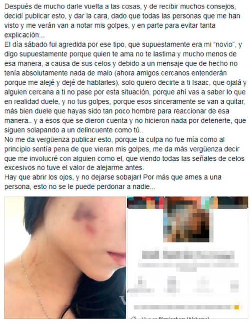 $!Porrista de Saraperos denuncia golpiza de su novio