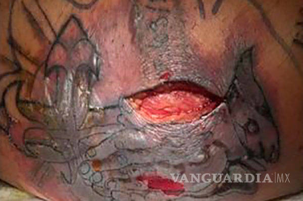 $!Estadounidense recién tatuado fue a nadar en Golfo de México y murió por una infección