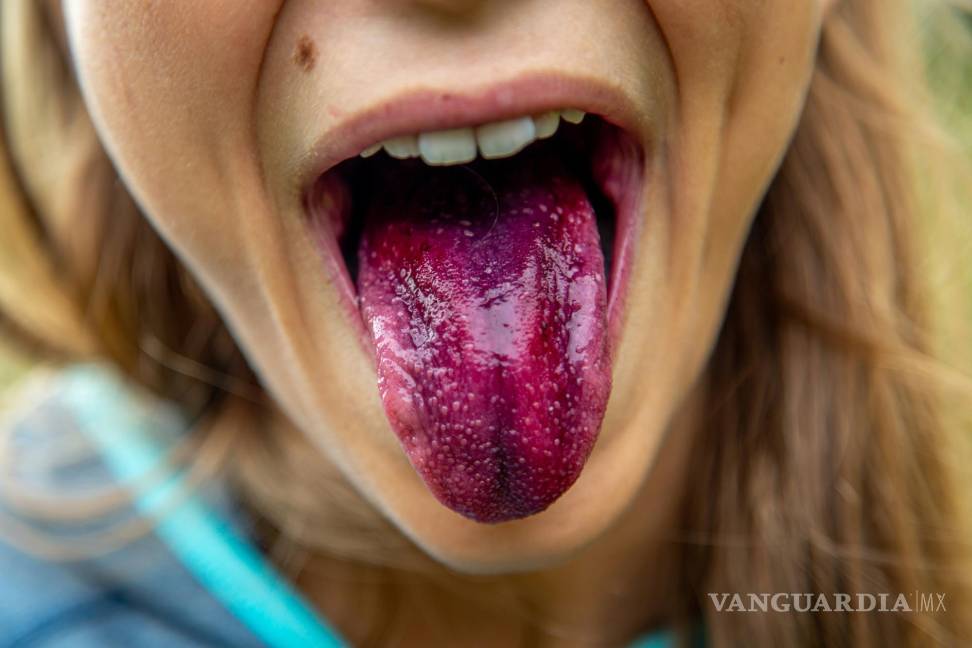 $!La lengua, aunque a simple vista parece un órgano simple dentro de nuestra boca, juega un papel fundamental en nuestra salud general.
