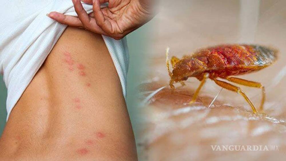 Alerta por plaga de chinches... ¿Cómo saber si te picó y qué debes hacer?