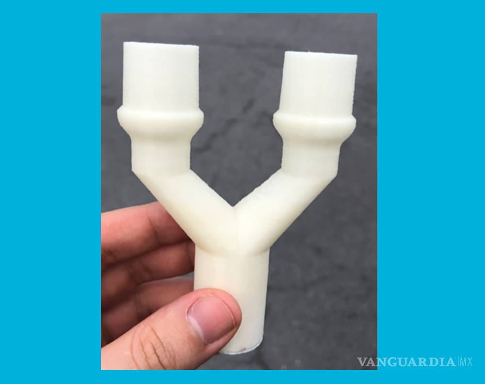 $!El esfuerzo de este médico salvará vidas en México y Monclova: multiplicará los ventiladores mecánicos