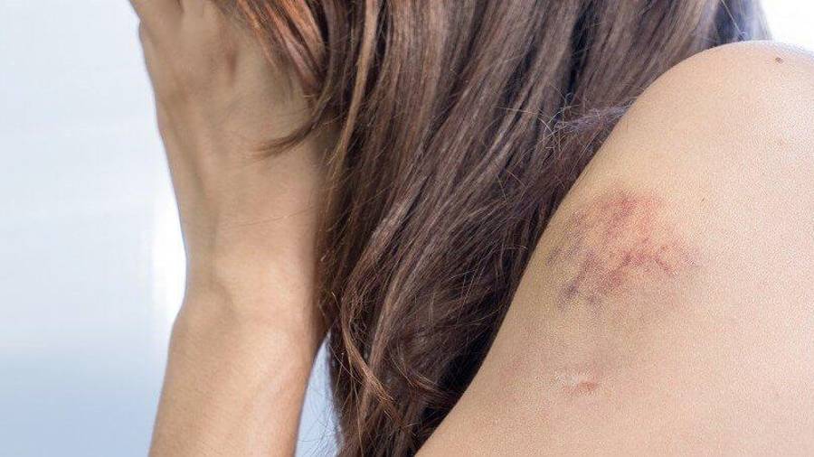 De acuerdo a los reportes de salud, se atiende una mujer diario derivado de violencia en su contra.