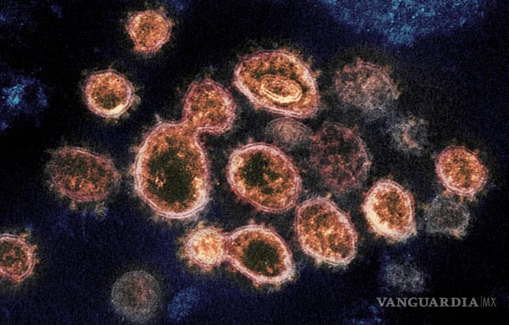 $!En esta imagen tomada con un microscopio electrónico en 2020, cortesía de los Laboratorios de las Montañas Rocosas de los Institutos Nacionales de la Salud, se ven partículas del virus SARS-CoV-2, causantes del COVID-19, aisladas de un paciente en Estados Unidos. AP/NIAID-RML