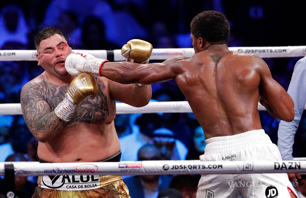 $!Así luce el rostro de Andy Ruiz tras su pelea con Anthony Joshua