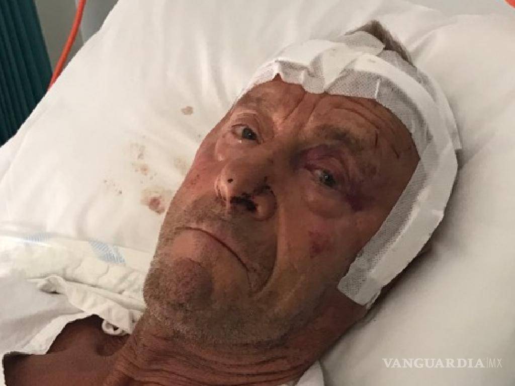 $!Apalean a un anciano por intentar frustrar un robo, le fracturaron el cráneo