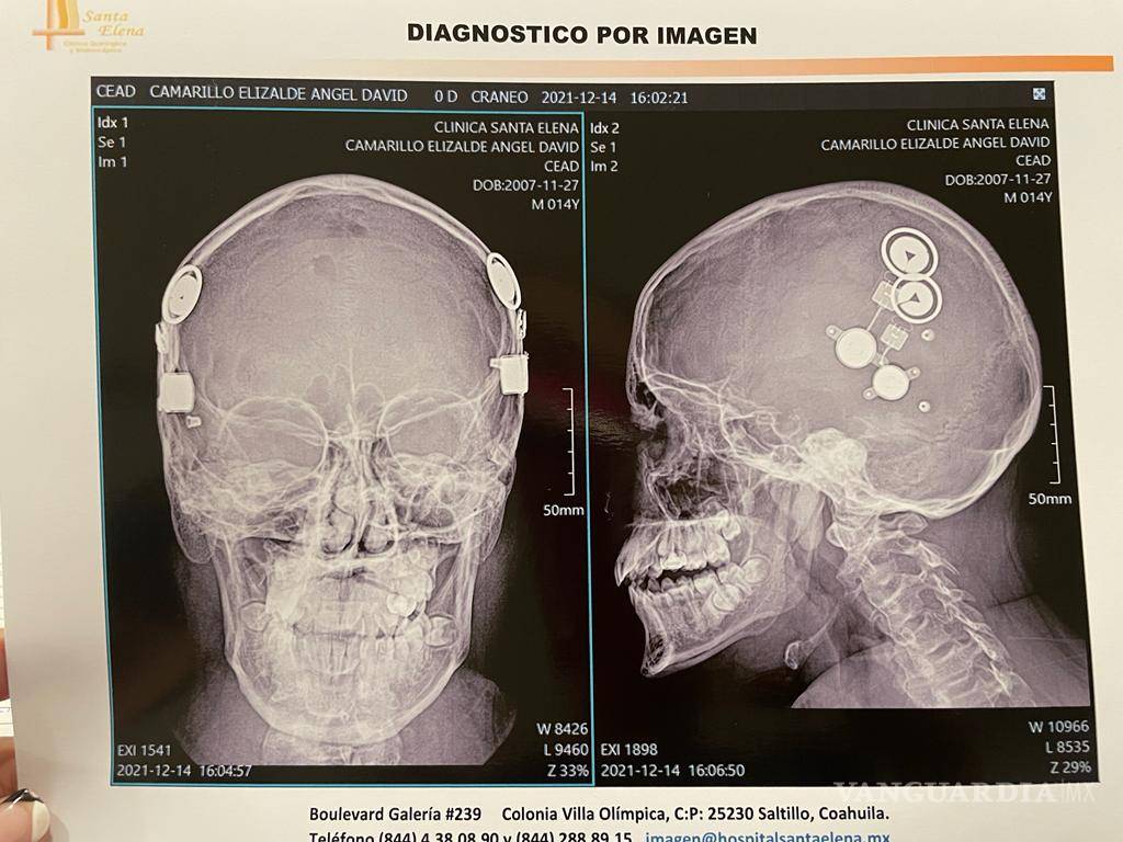$!Guadalupe Montes, la doctora saltillense que realizó (gratis) una cirugía única en México