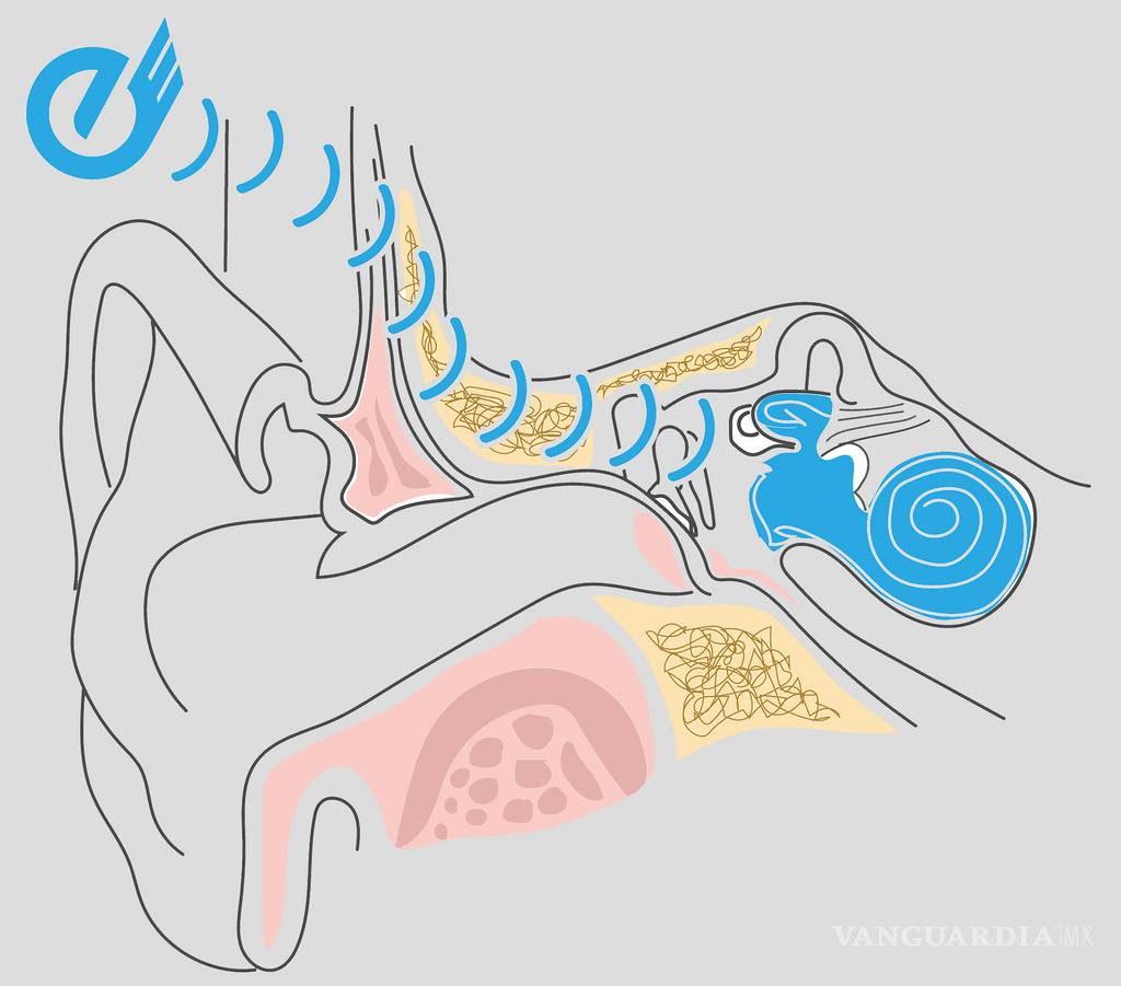 $!Mexicanos crean audífonos que conducen el sonido vía los huesos, sin afectar el oído