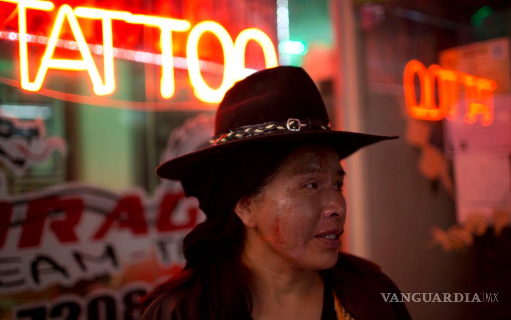 $!Tatuajes motivan a pacientes bolivianos con vitíligo