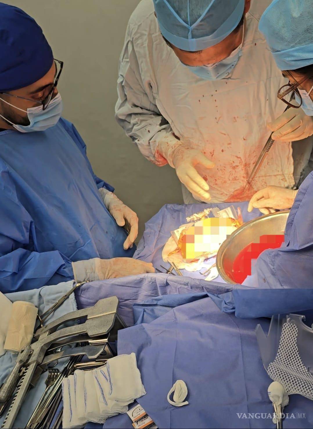 $!La paciente provenía del ISSSTE y fue diagnosticada con muerte encefálica tras un evento vascular cerebral.