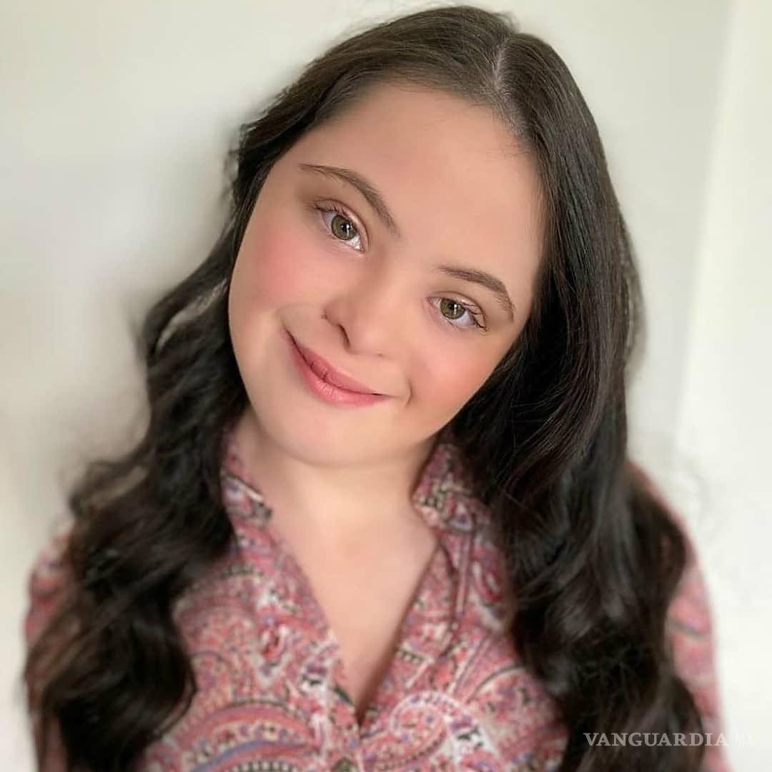 $!Gucci elige a modelo con síndrome de Down como su nuevo rostro