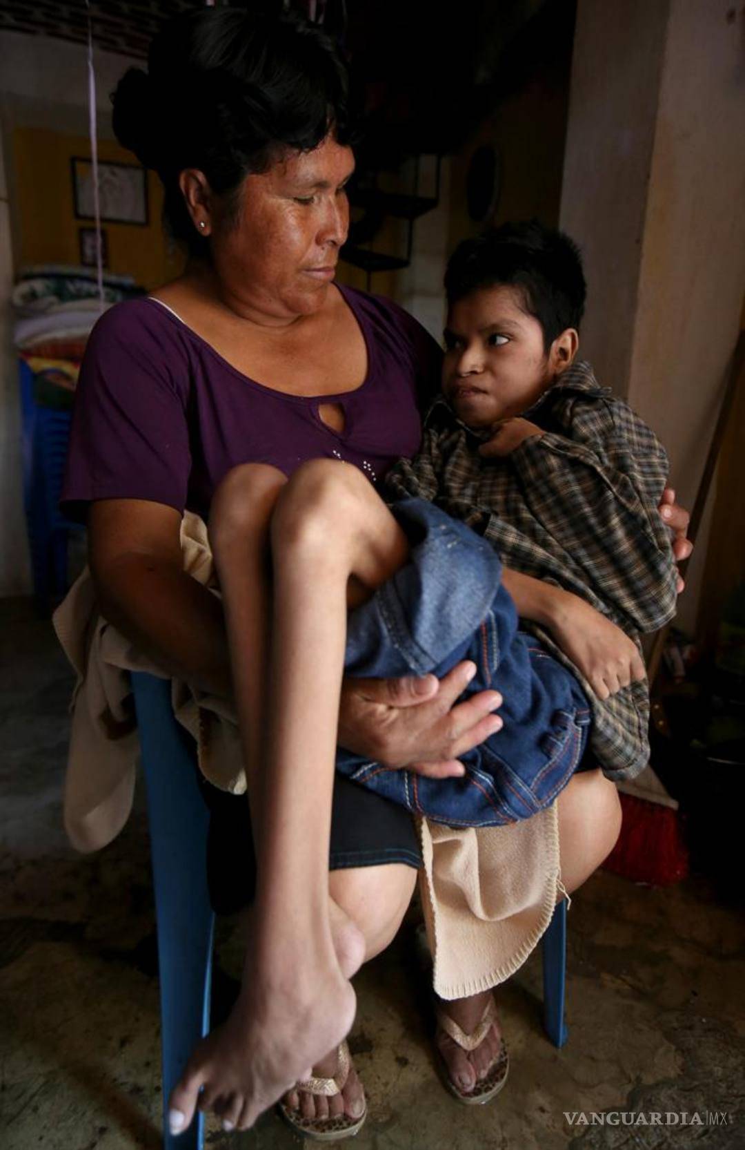 $!San Pedro Itzicán, un pueblo en México que muere de insuficiencia renal