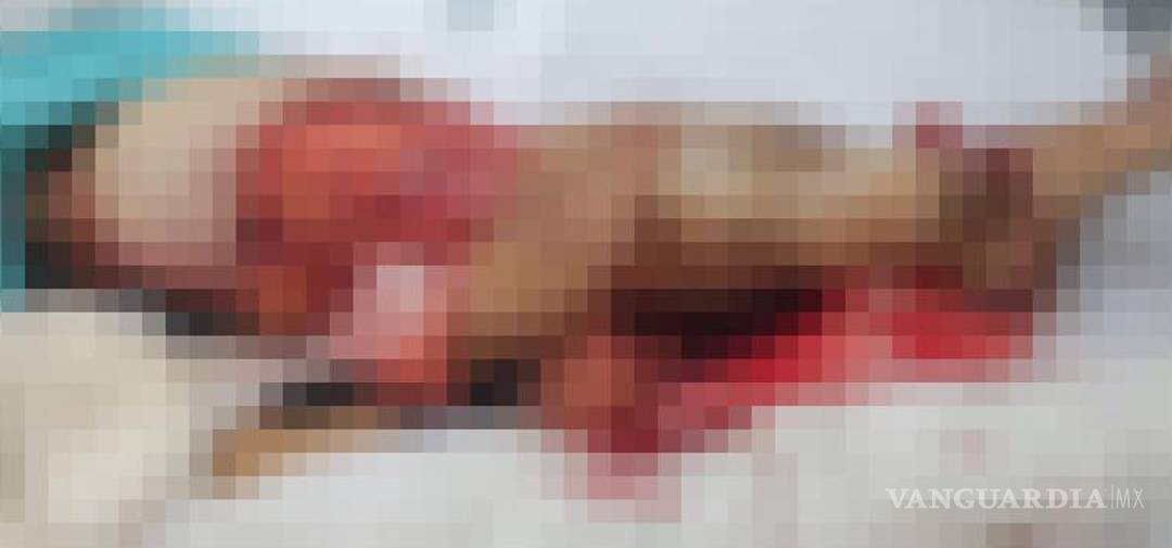 $!Familiares de Aglaé ¨N¨ esperan avances mientras la mujer permanece grave en el hospital.