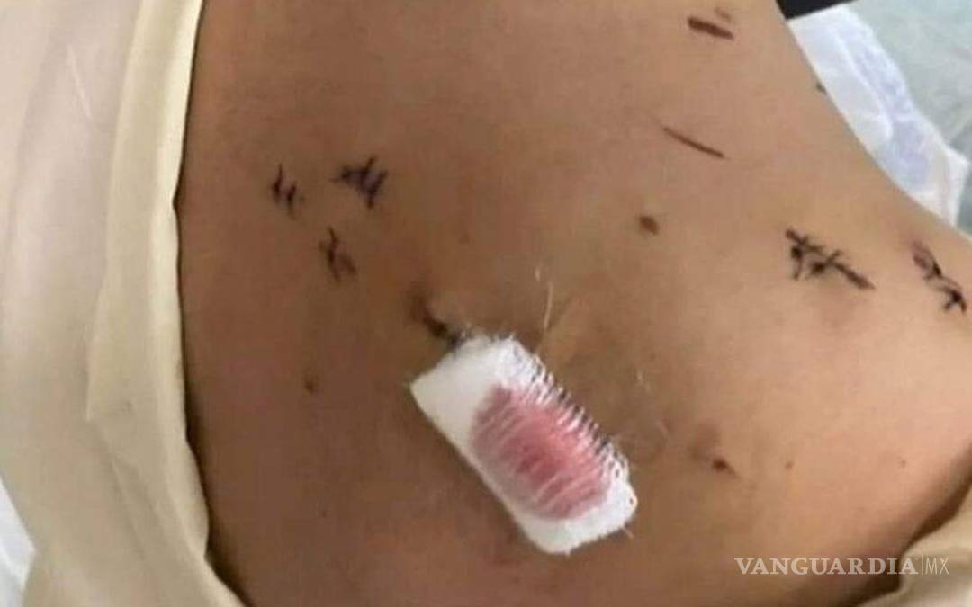 $!Tras el reclamo público, la Fiscalía General del Estado, Zona Centro, reclasificó el delito por el de lesiones agravadas y violencia familiar