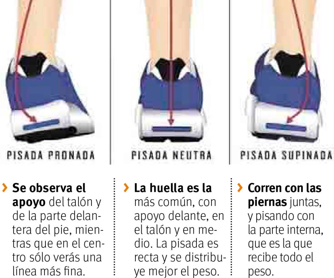 $!¿Te dolieron demasiado los pies? Hay que cambiar tenis